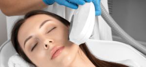 IPL Photofacial